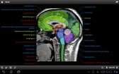 game pic for IMAIOS e-Anatomy